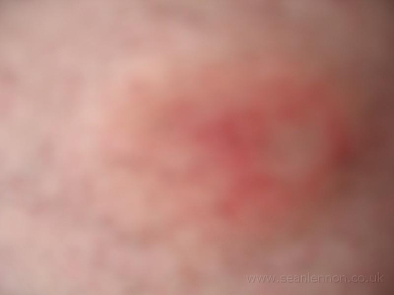 23 March 2005 - Sean's arse 043.jpg